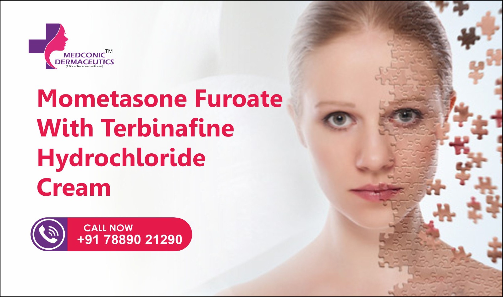 Mometasone-Furoate -With -Terbinafine -Hydrochloride -Cream