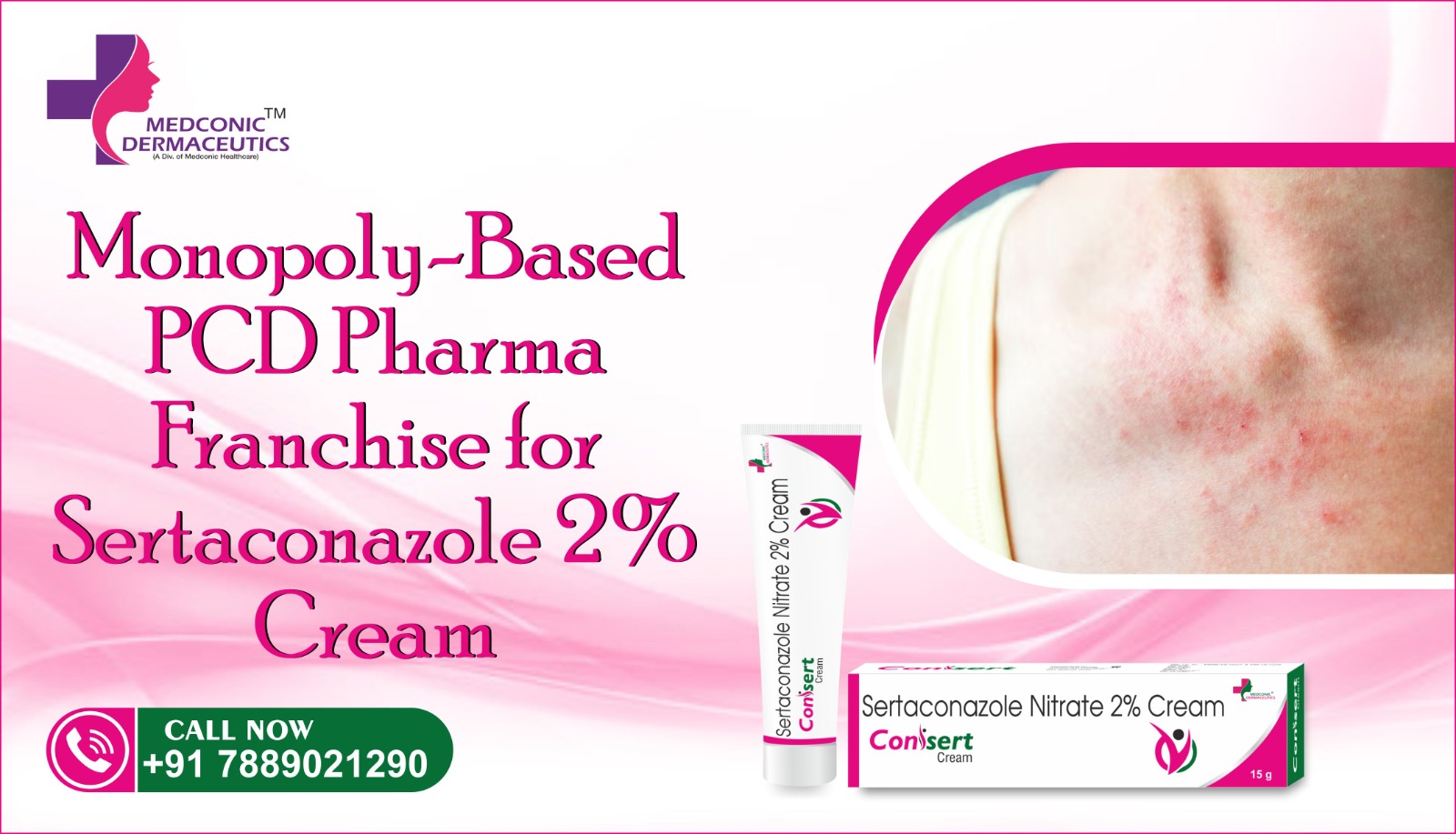 CONISERT - SERTACONAZOLE 2% CREAM